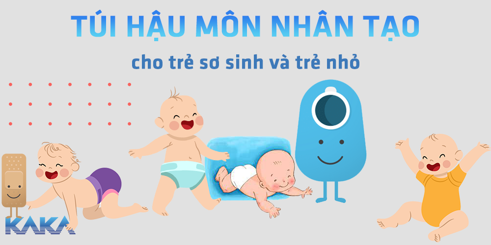 Túi hậu môn nhân tạo cho trẻ sơ sinh và trẻ nhỏ