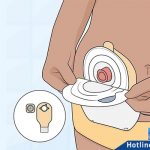 Tui-hau-mon-nhan-tao-2-manh