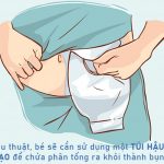 Tui-hau-mon-nhan-tao-cho-tre-nho