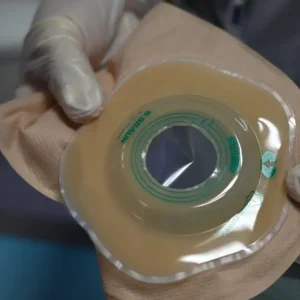 Keo chống rò rỉ (Stoma paste) dùng cho túi hậu môn nhân tạo