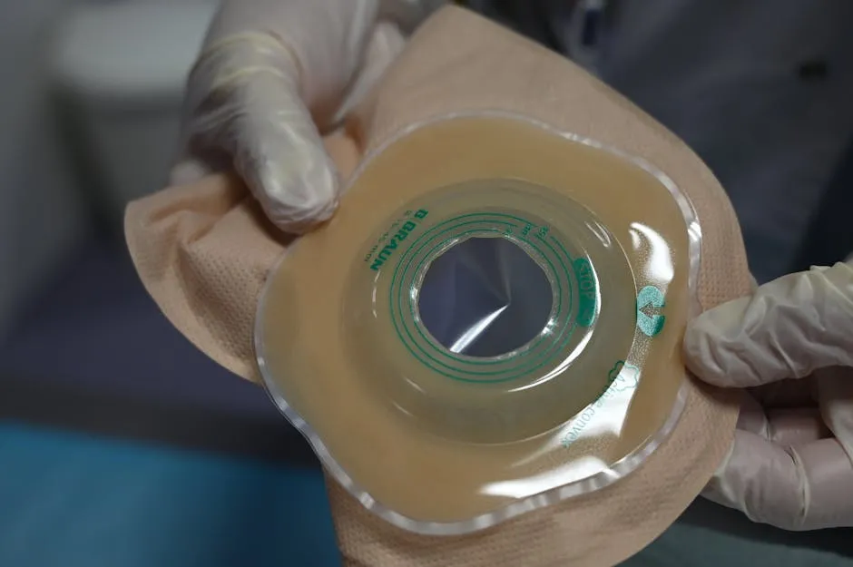 Keo chống rò rỉ (Stoma paste) dùng cho túi hậu môn nhân tạo